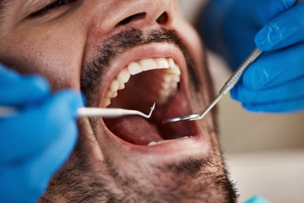 Best Urgent Dental Care for Toothaches in Moore, OK