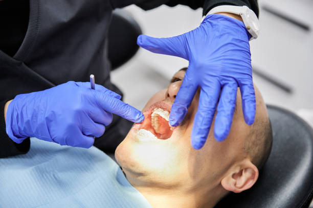 Best Dental Abscess Treatment in Moore, OK